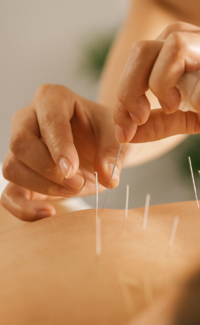 indicacions acupuntura mtc mujerindicacions acupuntura mtc mujer