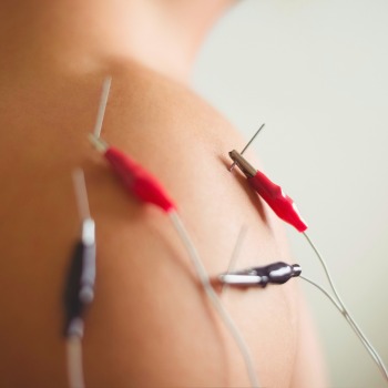 Moxibustion Traditional Chinese Medicine Treatment
